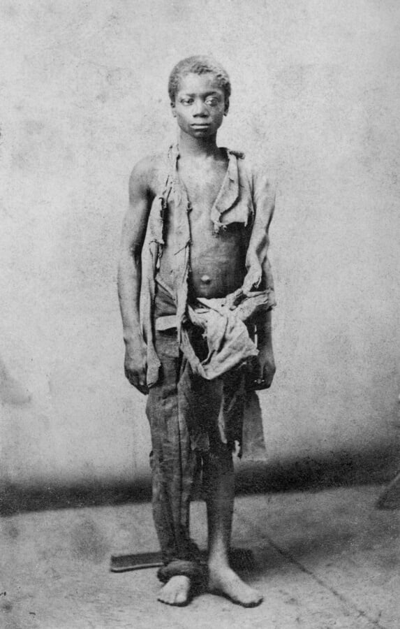 Young slave during the civil war reduced to such poverty he is wearing only rags. Ca. 1863.                                                      is wearing only rags. Ca. 1963.                             salem, Virginia. Afterward, in gruesome vengeance,